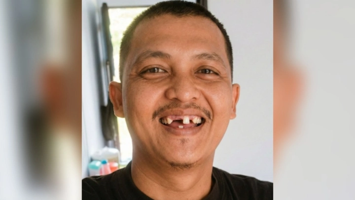 Gigi Hilang