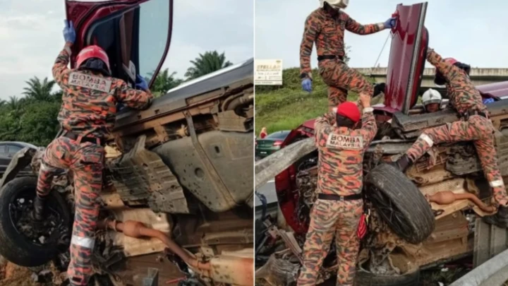 Wanita Meninggal Dunia Selepas Parah