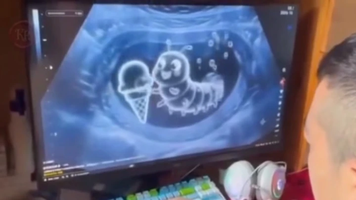 ULTRASOUND
